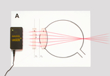 Das Bild zeigt ein Experimentiergerät mit einem Laserstrahl, der durch eine Linse geleitet wird. Die grafische Darstellung verdeutlicht, wie der Lichtstrahl bei der Durchquerung der Linse abgelenkt wird.